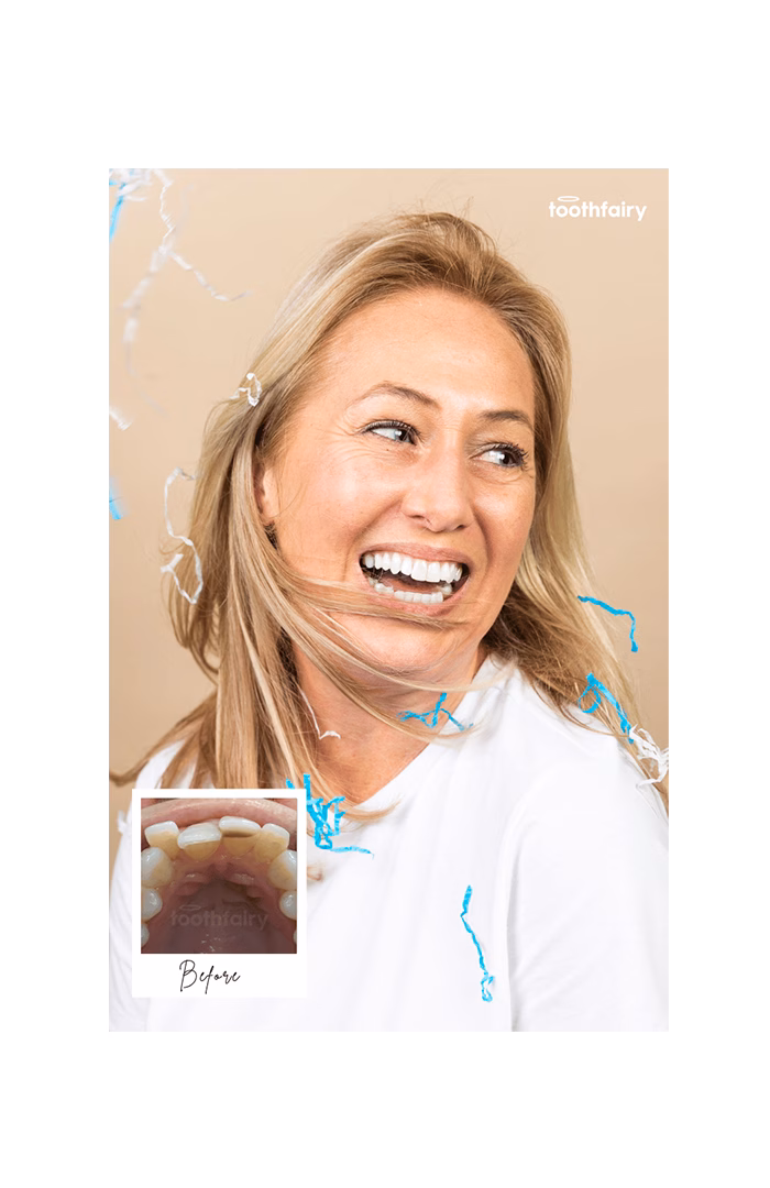 Toothfairy - Planned to perfection
